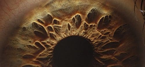 Imagen microscópica del iris de un ojo